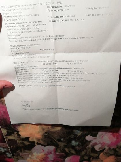 Киста яичника