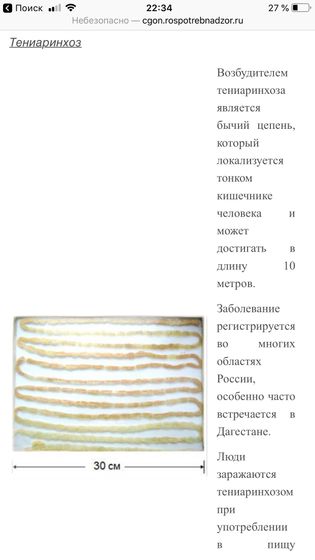 Глисты ?? заранее извиняюсь