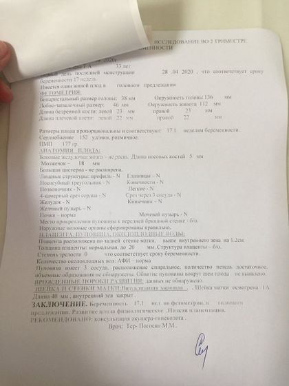?17 недель ?