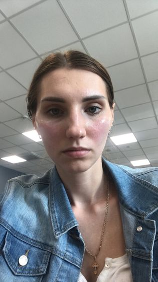 РОЗАЦЕА !!!! 🆘🆘🆘🆘🆘🆘🆘🆘🆘🆘🆘Девочки подскажите у кого может было ?