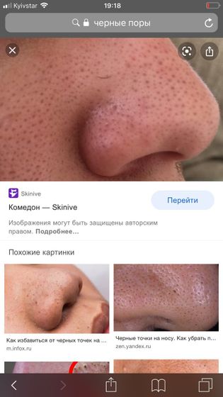 Чёрные поры