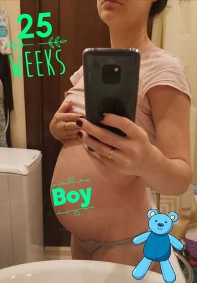 25 неделек?