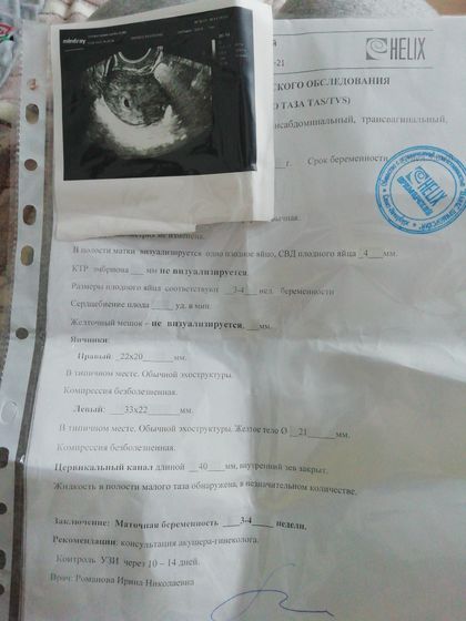 Девочки, привет, сегодня 22