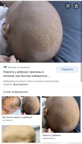 Девочки, как избавиться от