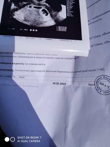 Двойной сюрприз!)))