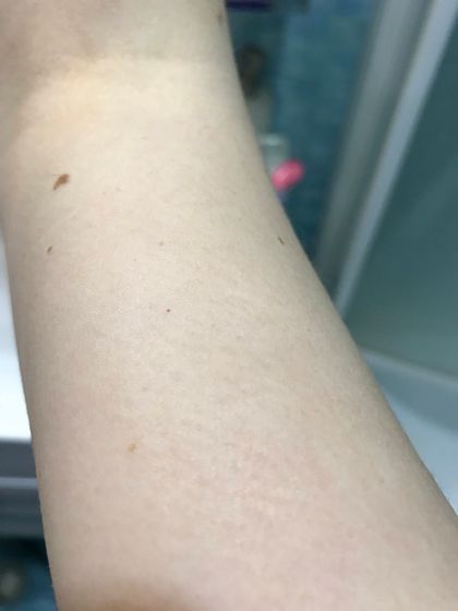 Красные пятна/кровоизлияния?