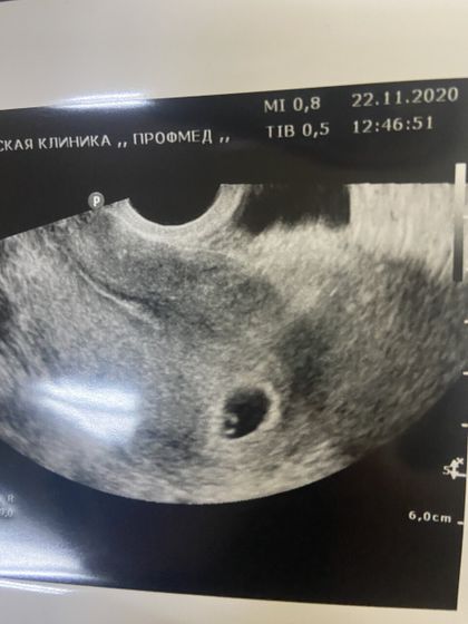 Узи 🥰