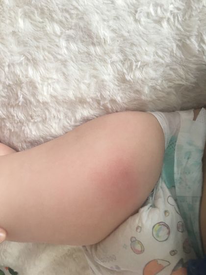 Вчера утром делали прививку