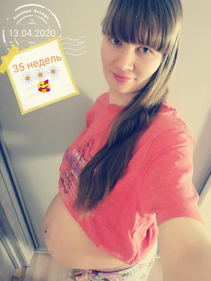 Наши 35 неделек)))