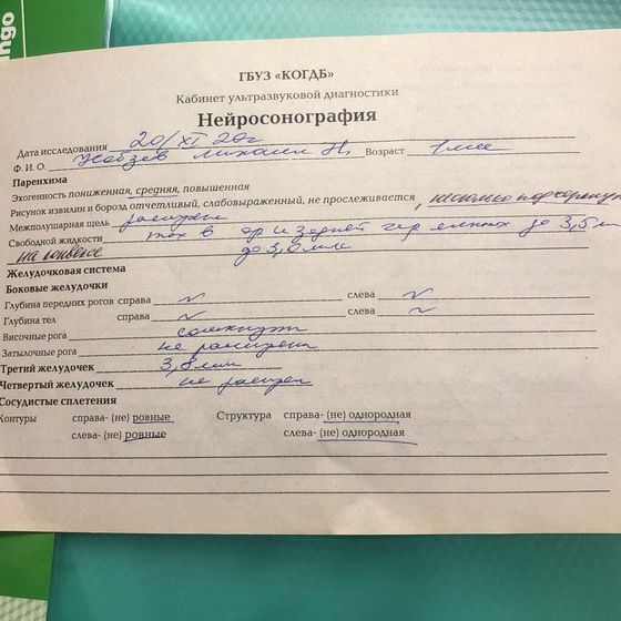 Невыраженный гидроцифалия