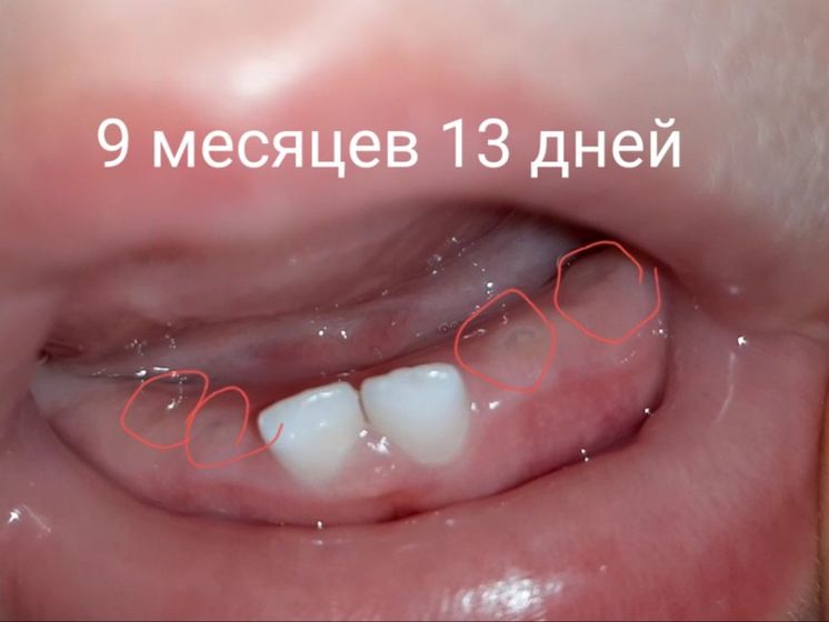 Зубные дни!
