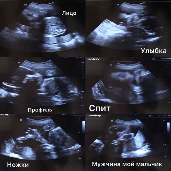 Просто бесценные кадры любой мамочки ????
