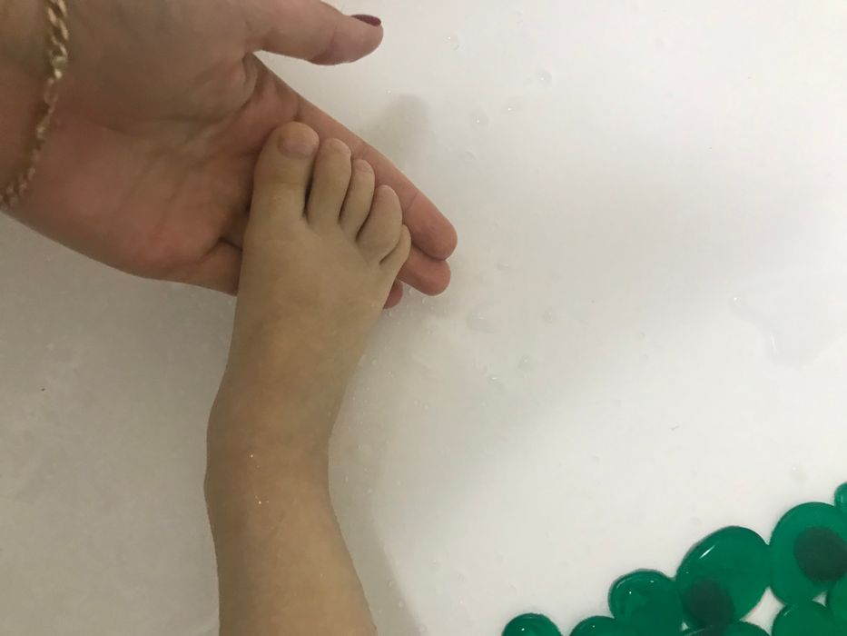 Опухший палец на ноге у ребёнка