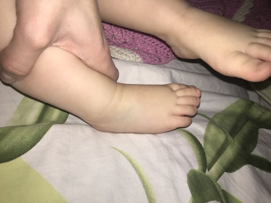 Перелом или трещина ноги у ребенка-у кого было?